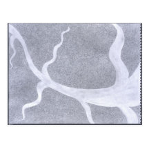 eyevein cartao postal