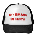 No em here brain bone