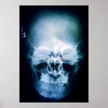 X-Cabeça Posters
