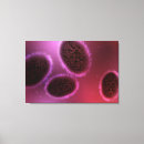 Pesquisar por doença infecciosa impressão de canvas Horizontal