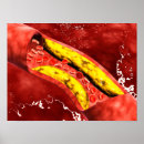 Pesquisar por chapa pósteres pôsteres Ilustração