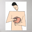 Pesquisar por cancer de estômago Doença