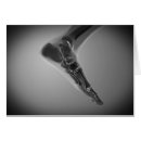 Pesquisar por ossos do pé cartoes postais Osso do calcanhar