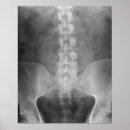 Pesquisar por xray pôsteres Médico