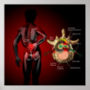 Pesquisar por lombar pôsteres Medicina