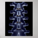 Pesquisar por lombar pôsteres Do trabalho