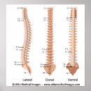 Pesquisar por coluna vertebral pôsteres Anatomia