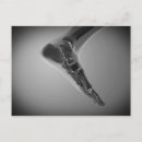 Pesquisar por ossos do pé cartoes postais Pés