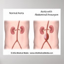 Pesquisar por abdômen pósteres pôsteres Médico