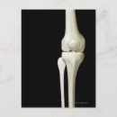 Pesquisar por ossos humanos cartoes postais Médica