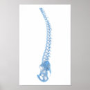 Pesquisar por vértebras cervicais artes pôsteres Cervical