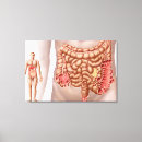 Pesquisar por doença impressão de canvas Epidemiologia