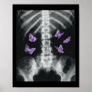 Pesquisar por xray pôsteres Crânio
