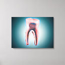 Pesquisar por vasos sanguíneos impressão de canvas Ilustração