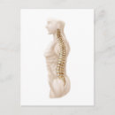 Pesquisar por coluna vertebral cartoes postais Médico