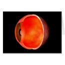 Pesquisar por olho humano cartoes postais Conjuntiva