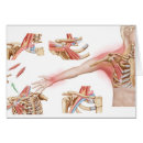 Pesquisar por inflamação cartoes postais Distúrbio