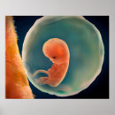 Pesquisar por feto pôsteres Saco amniotic