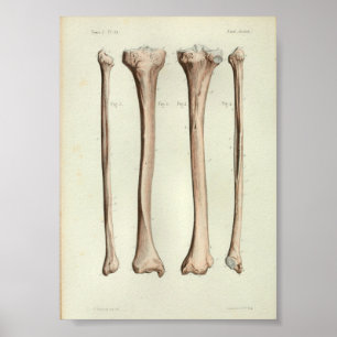 1844 Vintage Anatomy Impressão Tibia Fibula