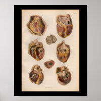 1879 Vintage Bock Anatomy Impressão Heart Muscles