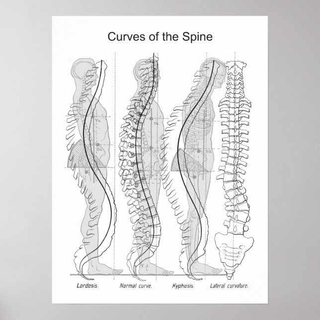 Abnormal Curves of the Spine Poster Chiropractic (Frente)