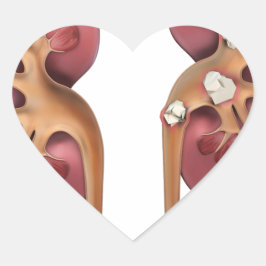 Adesivo Coração rins