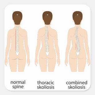 Adesivo Quadrado Deformação espinal