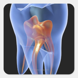 Adesivo Quadrado Dente, secção transversal transparente de um mol