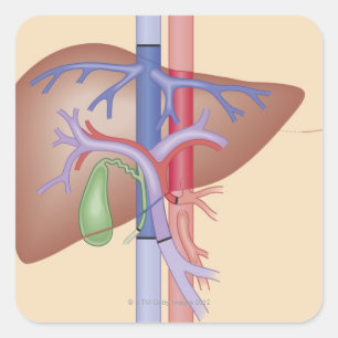 Adesivo Quadrado Procedimento da transplantação do fígado