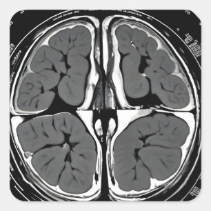Adesivo Quadrado ressonância magnética cerebral