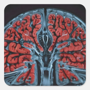 Adesivo Quadrado ressonância magnética cerebral