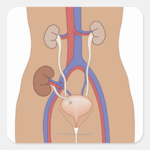Adesivo Quadrado Transplantação do rim