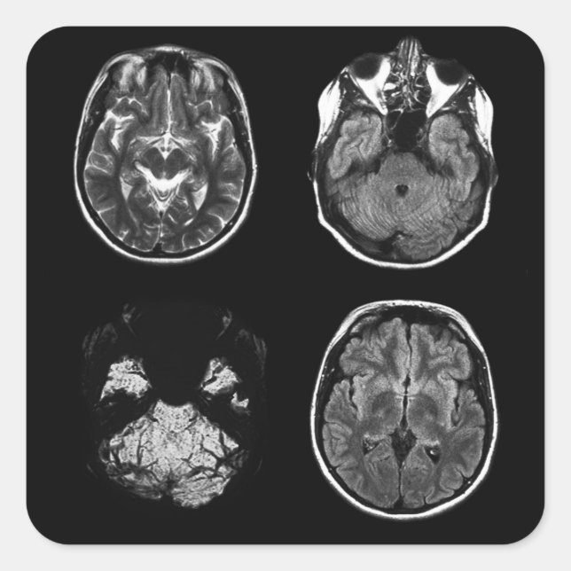 Adesivo Quadrado Varredura por ressonância magnética do cérebro (Frente)