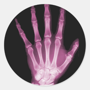 Adesivo Redondo Mão cor-de-rosa do esqueleto do raio X