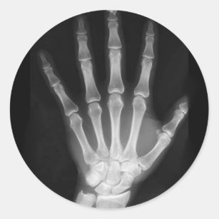 Adesivo Redondo Mão do esqueleto do raio X de B&W