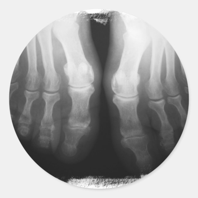 Adesivo Redondo Preto & branco de esqueleto humanos de ossos dos (Frente)