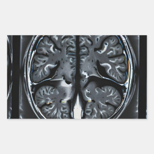 Adesivo Retangular ressonância magnética cerebral