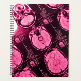 Agenda MRI magenta: uma visão axial do cérebro