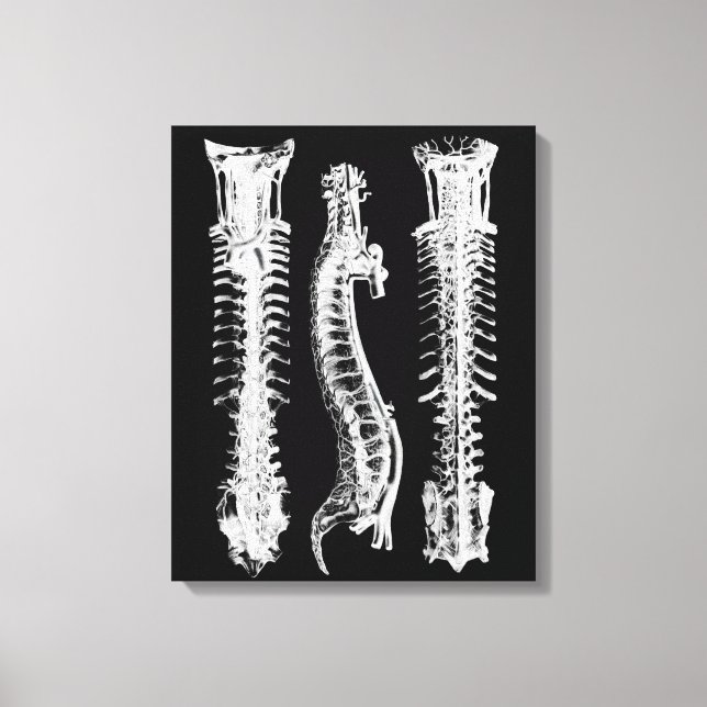 Anatomia da Arte Canvas Grande da Coluna Humana (Frente)