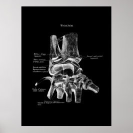 Anatomia do pulso Decoração ortopédica Poster