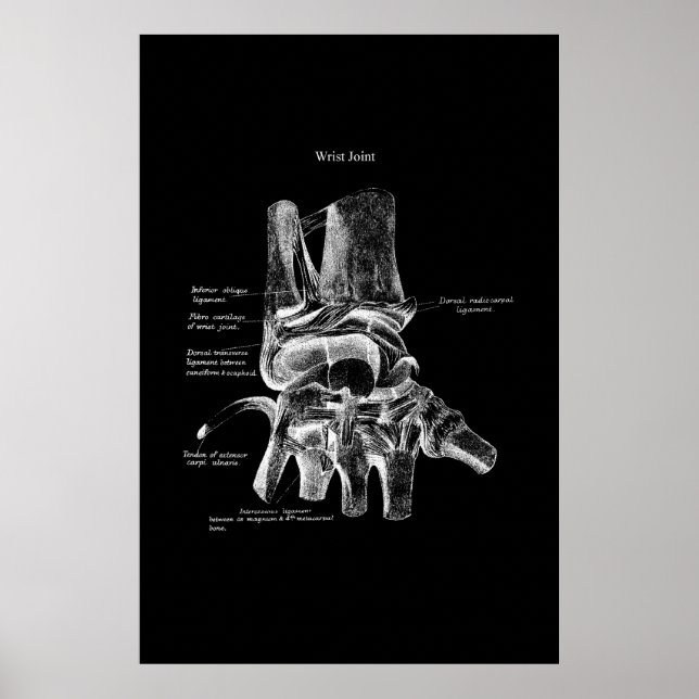 Anatomia do pulso Decoração ortopédica Poster (Frente)