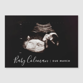 Anunciar Gravidez Nome do Sonograma Magnet