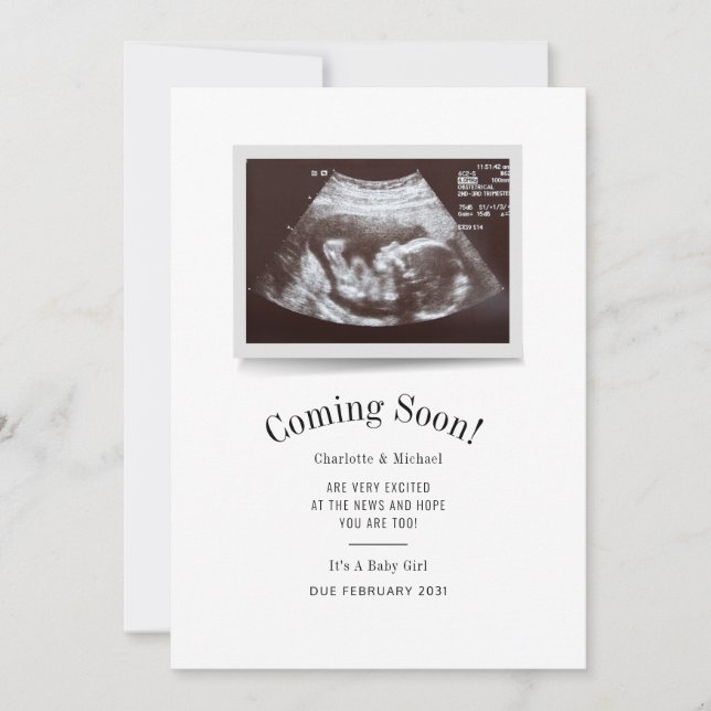 Anúncio Coming Soon Ultrasound Photo Scan Baby Reveal (Frente)