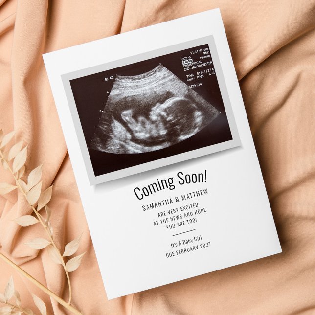 Anúncio de Gravidez de Foto Ultrassônica (Sonogram Pregnancy Announcement Baby Scan Photo Card)