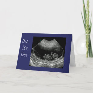 Anúncio New Baby Anouncement