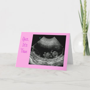 Anúncio New baby Pink