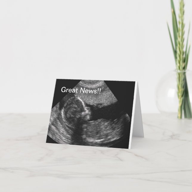 Anúncio New Baby Ultrasound (Frente)