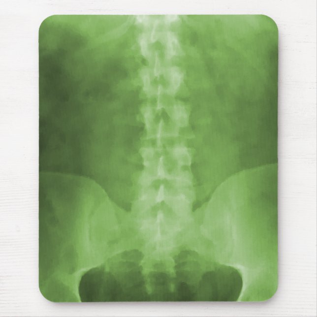 Arte verde Mousepad do raio X de Digitas (Frente)