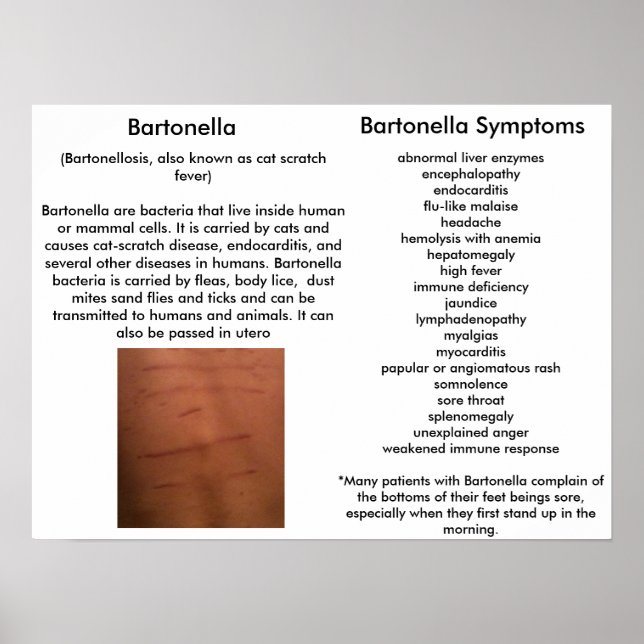 Bartonella Sintomas Educacional Poster (Frente)