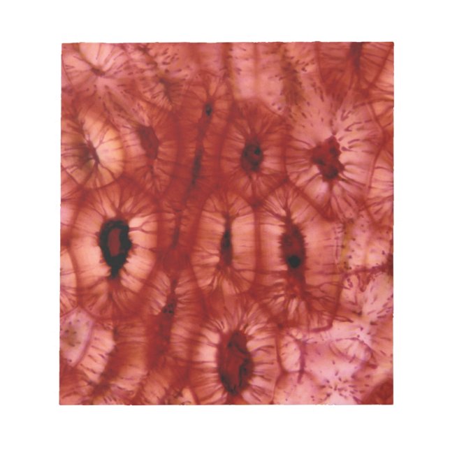 Bloco De Notas Células esclerenchymas de poço de cereja (Frente)